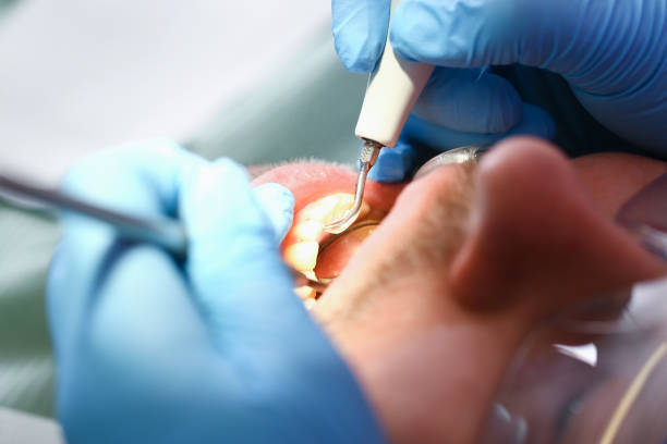 Best Broken Tooth Emergency  in Pickerington, OH
