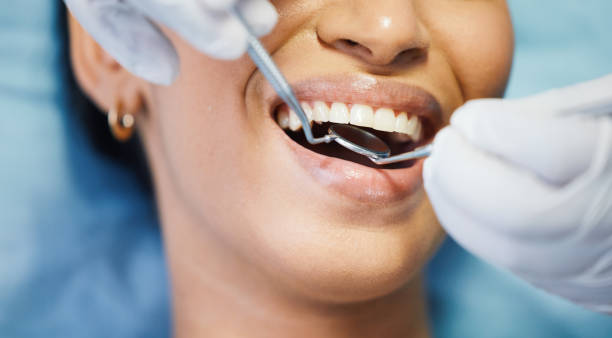 Dentist for Dental Trauma in OH