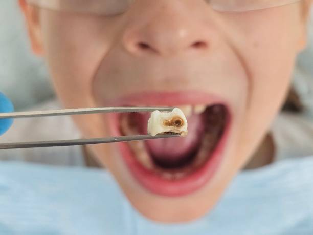 Best Dentist for Tooth Abscess  in Pickerington, OH