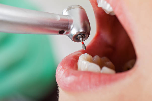 Best Knocked-Out Tooth Emergency  in Pickerington, OH